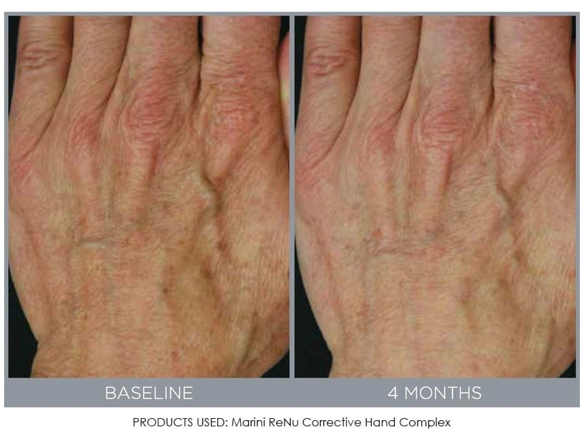 Jan Marini ReNu Corrective Hand Complex 3 Jan Marini ReNu Corrective Hand Complex - Image 3