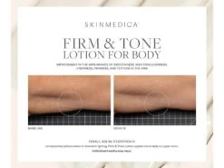 SkinMedica Firm & Tone Body Lotion -Care Products 134uhvit 202208182045383698