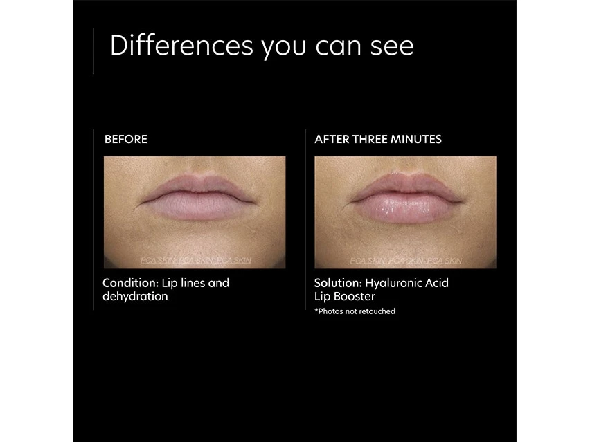 PCA SKIN Hyaluronic Acid Lip Booster 8 PCA SKIN Hyaluronic Acid Lip Booster - Image 8