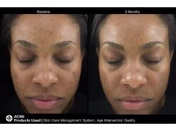 Jan Marini Age Intervention Duality MD -Care Products 4r50jibd 202205201345218353