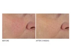 Dr. Dennis Gross Skincare Advanced Retinol + Ferulic Overnight Texture Renewal Peel -Care Products 5fl1mgii 202108121304467282