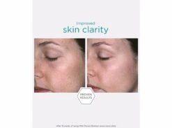 NEOSTRATA Restore PHA Facial Cleanser 7 NEOSTRATA Restore PHA Facial Cleanser -Care Products e1e2g2de 202210051737461227