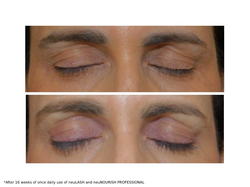 NeuLASH & NeuNOURISH PROFESSIONAL Lash Enhancing Duo 3 NeuLASH & NeuNOURISH PROFESSIONAL Lash Enhancing Duo - Image 3