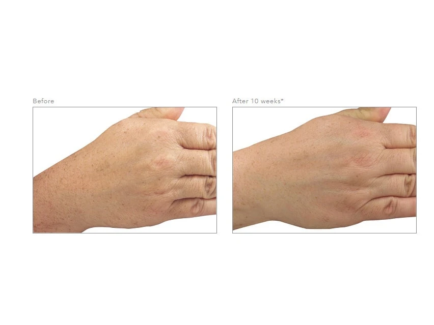 Revision Skincare Lumiquin 2 Revision Skincare Lumiquin - Image 2