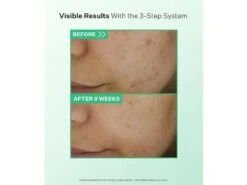 StriVectin Multi-Action Gentle Daily Clarifying Cleanser -Care Products nxnt2iiw 202303221420237202