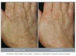 Jan Marini ReNu Corrective Hand Complex 8 Jan Marini ReNu Corrective Hand Complex -Care Products oigz5hwm 201809111634169450