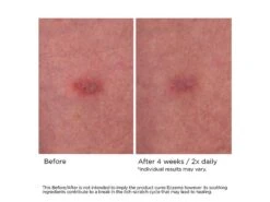 NassifMD® Eczema Soothing Skin Cream -Care Products por3pcxt 202103051356087966