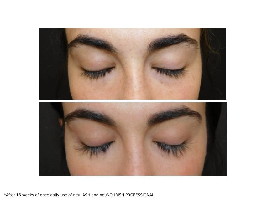 NeuLASH & NeuNOURISH PROFESSIONAL Lash Enhancing Duo 2 NeuLASH & NeuNOURISH PROFESSIONAL Lash Enhancing Duo - Image 2