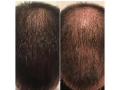 Zenagen Revolve Men's Thickening Shampoo -Care Products uy1aapzo 202306011544288037