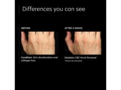 PCA SKIN C&E Hand Renewal 13 PCA SKIN C&E Hand Renewal -Care Products wwpa02vl 202205262011029430
