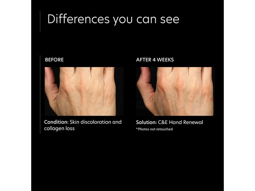 PCA SKIN C&E Hand Renewal 5 PCA SKIN C&E Hand Renewal - Image 5