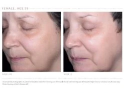 Emepelle Night Cream -Care Products x5kifeuj 202102161744026675