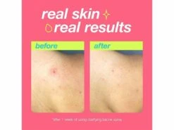 Dermalogica Clear Start Clarifying Bacne Spray -Care Products yry223aa 202306121410164345