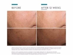 SkinCeuticals Discoloration Defense -Care Products zueh23mx 202306021954483556