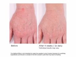 NassifMD® Eczema Soothing Skin Cream -Care Products zyk35ubu 202103051350466941